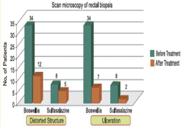 和聚代理sabinsa的乳香萃取物boswellin改善潰瘍性結腸炎