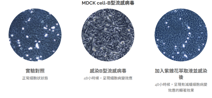 和聚紫錐花萃取物emunepower抑制B型流感病毒