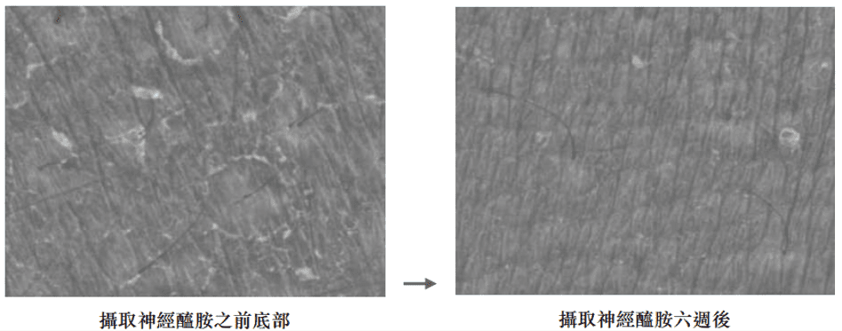 米萃取(含神經醯胺)助於增加皮膚水分