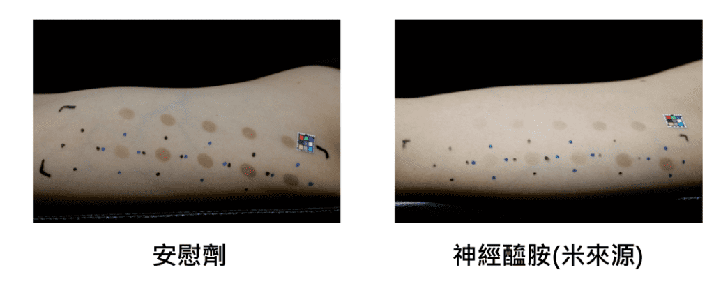 米萃取(含神經醯胺)助於抵禦紫外線造成的色素沉澱