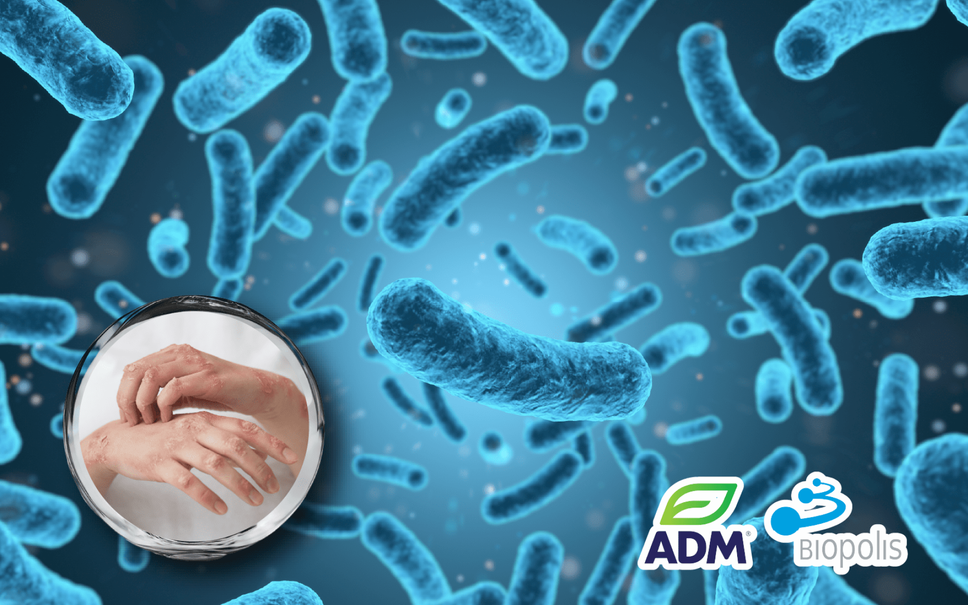 ADM Biopolis AD-1 複方益生菌 – 西班牙研發三株專利菌株